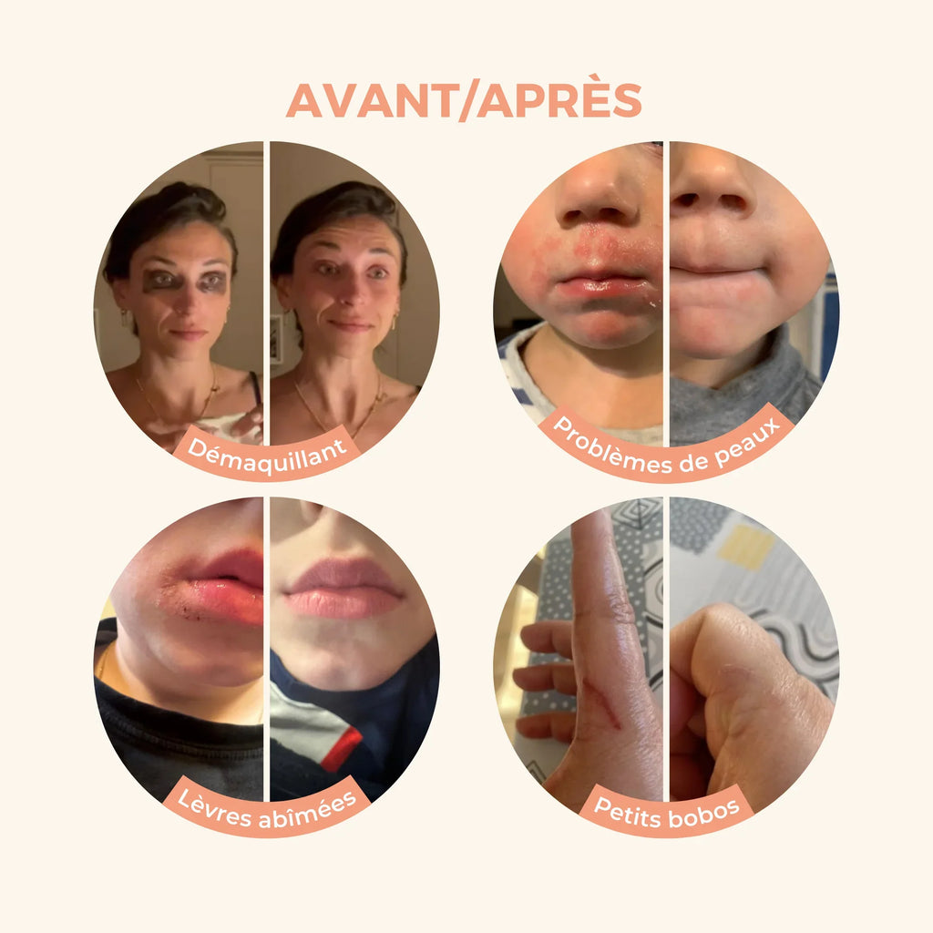 Baume Magique - Les Petits Prödiges